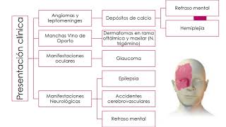 Síndrome de Struber Weber por Gabriela Morales [upl. by Enaelem]