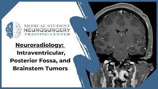 Neuroradiology Intraventricular Posterior Fossa and Brainstem Tumors [upl. by Misti]