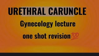 urethral caruncle gynecology lecture [upl. by Shira907]