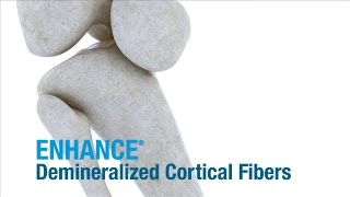 Enhance® Demineralized Cortical Fibers  ConMed Product Video [upl. by Erialb]