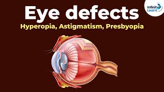 Eye defects  Hyperopia Astigmatism Presbyopia  Dont Memorise [upl. by Jephthah]