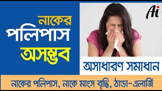 Polymed  নাকের পলিপাস চিকিৎসার ঔষধ  Daktar Barta [upl. by Naehs9]