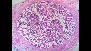 Practical histology of fallopian tubeamp vagina [upl. by Nosredna]