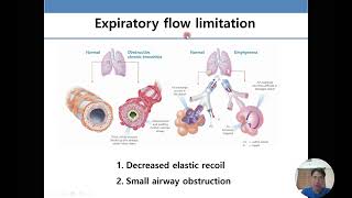 폐기능 검사의 이해와 해석 Pulmonary function test [upl. by Ceporah]