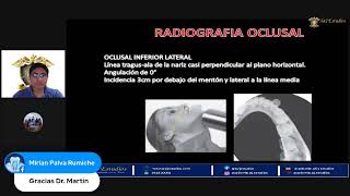 ENAO2023 Radiología Oral y Maxilofacial  quotTécnicas intraorales en Radiologíaquot [upl. by Brader]