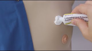 How to apply lidocaine cream to your port [upl. by Dnomde]