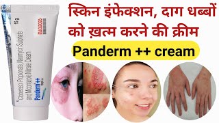 Panderm cream  Panderm cream Panderm cream use in Hindi  pendram cream ke fayde  shorts [upl. by Naej988]