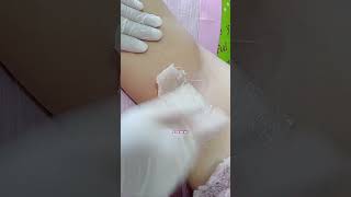 Under Arm Waxing 😮 our skin are smooth and whitening 🤗🥰 [upl. by Jeri959]