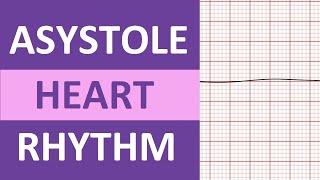 Asystole Heart Rhythm ECG Causes Treatment Nursing NCLEX Review EKG Flatline [upl. by Mukund]