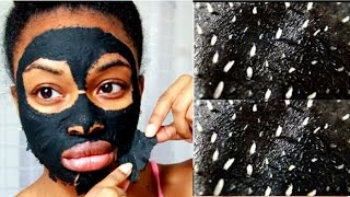 DIY Blackhead and Whitehead Remover Peel Off Mask  BLACK MASK [upl. by Corena632]