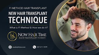 New Hair Transplant Technique 2023  Fi Hair Transplant [upl. by Smallman440]