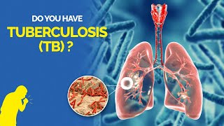 What is Tuberculosis TB Symptoms Causes Diagnosis and Treatment [upl. by Anneres573]