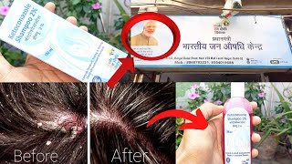 How to Use Ketoconazole Shampoo 2  Jan Aushadhi Kendra Ketoconazole Shampoo Benefits [upl. by Tice]