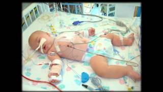 Hope for Hearts Living with Congenital Heart Defects CHD [upl. by Anilet187]