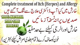 kharish ka ilaj in urduhindi Complete treatment of itch Herpes and allergy alerji ka ilaj [upl. by Susejedesoj]