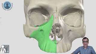 Skull  Norma Frontalis [upl. by Swihart]