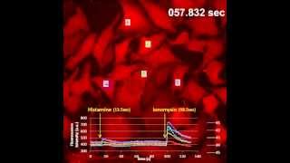 Calcium imaging in HeLa cells with CaTM2 AM [upl. by Papst]