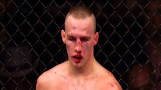 Robbie Lawler vs Rory Macdonald 2  Sweet Dreams [upl. by Aletha323]