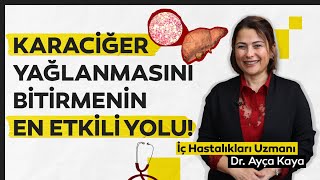 Karaciğer yağlanması neden olur karaciğer yağlanmasının en etkili tedavi yöntemleri nelerdir [upl. by Tomasina]