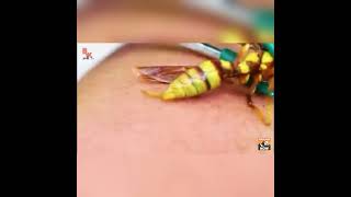 wasp sting  slowmotion video [upl. by Fiedler519]