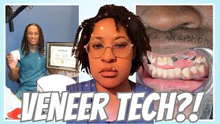 TikTok Veneer Tech Are Ruining Peoples Teeth [upl. by Nileuqcaj]