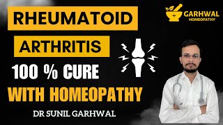 Rheumatoid Arthritis Homeopathy Treatment  Rheumatoid Arthritis Homeopathic Treatment in Hindi [upl. by Narf]