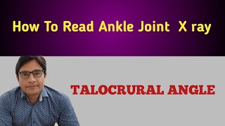 How To Measure TALOCRURAL ANGLE On Ankle X ray [upl. by Anamor346]