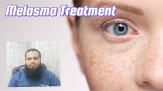 Chemical Peels HyperpigmentationMelasma of Face Dr Faisal Mansoor [upl. by Amsden]