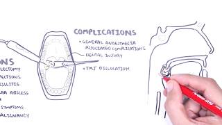 Acute Tonsillitis  causes viral bacterial pathophysiology treatment tonsillectomy [upl. by Aryaz756]