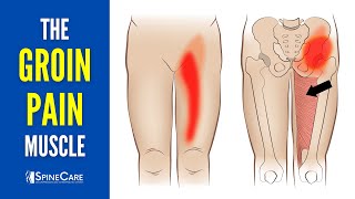 The Groin Pain Muscle How to Release It for INSTANT RELIEF [upl. by August]