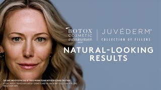 NaturalLooking Results 101  Can you achieve them with BOTOX® Cosmetic or JUVÉDERM® Fillers [upl. by Wanyen923]