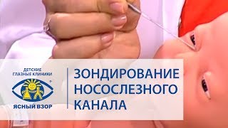 Баласанян ВО Зондирование носослезного канала [upl. by Uuge]