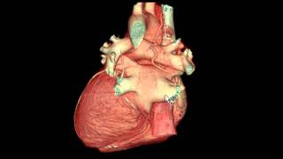 External Features of the Heart in 3D [upl. by Neelloc]