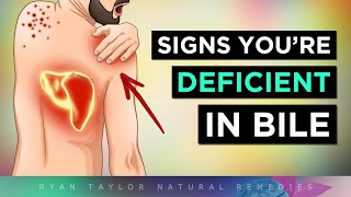 12 Strange Signs of a BILE Deficiency [upl. by Alvie]