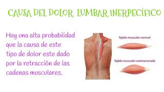 DOLOR LUMBAR INESPECIFICO [upl. by Gnap80]