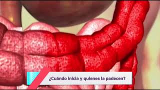 ¿Que es la colitis [upl. by Tulley]