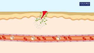 Animation 241 Inflammatory response [upl. by Melvina]