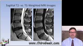 Dr Gillard lectures on How to Read Your Lumbar MRI [upl. by Dorry]