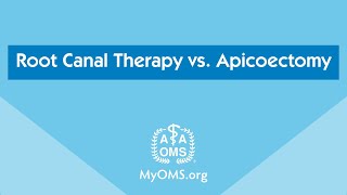 Root Canal Therapy vs Apicoectomy [upl. by Ahiel928]