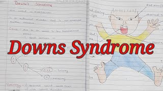 Downs Syndrome  Trisomy 21  Mongolism  Notes With Diagrams To Understand Better  Cx and Features [upl. by Elleraj]