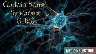 GBS  GuillainBarre Syndrome  Everything Explained  In Urdu Hindi [upl. by Sylram]