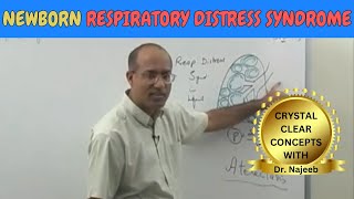 Newborn Respiratory Distress Syndrome  Pathophysiology🫁 [upl. by Anirrak]