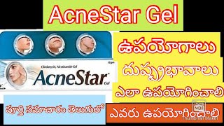 Acnestar gel uses sideeffects in telugubest ointment for pimples in teluguanceacnescardarkspots [upl. by Zedekiah554]