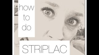 how to do STRIPLAC [upl. by Radu130]