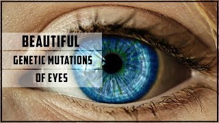 Beautiful genetic mutations of eyes [upl. by Uhn]