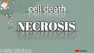 Types of Necrosis part2 [upl. by Fanya]