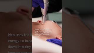 Skin Pigmentation Treatment with Pico Laser  Sydney [upl. by Nevins71]