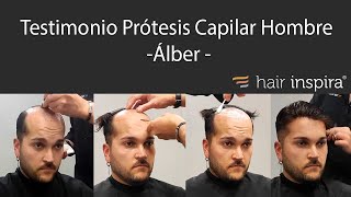 Testimonio prótesis capilar hombre Álber  Hair Inspira [upl. by Tnomad726]