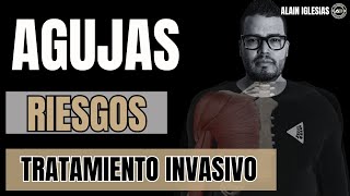 ▪️✅PUNCIÓN SECA ELECTROPUNCION TECNICAS INVASIVAS FACTORES DE RIESGO▪️ [upl. by Nnayelsel]