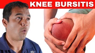 Healing Knee Bursitis Top 5 Treatments for Rapid Healing [upl. by Halladba]